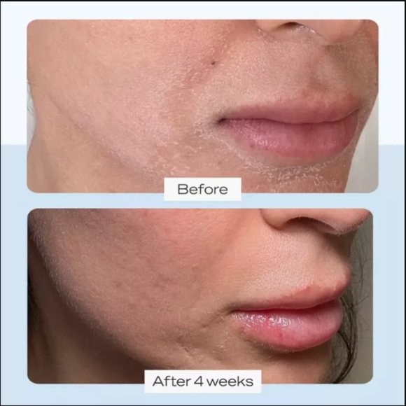 🔥3/$30 NEW FIRST AID BEAUTY FAB Ultra Repair Cream Intense Hydration Dry Skin - Picture 5 of 5